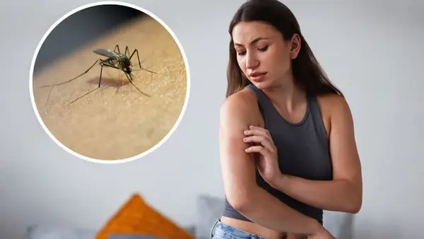 Укусы насекомых летом: как отличить, чем лечить и когда срочно к врачу