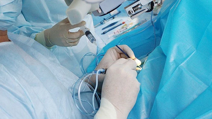 удаление катаракты