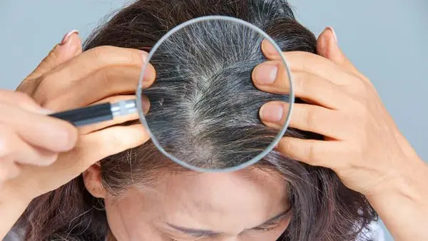 Можно ли остановить раннее поседение волос: объяснение трихолога