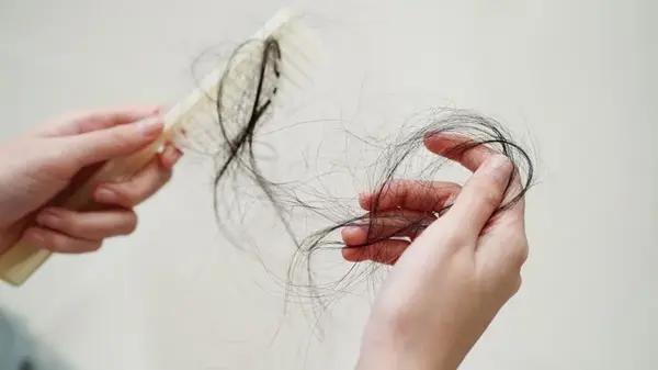 Популярная прическа может привести к залысинам: что советуют трихологи