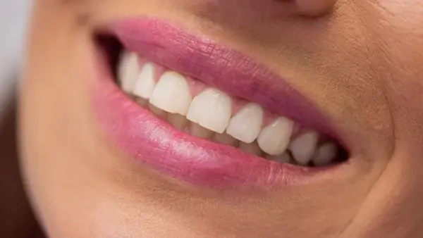 Вот что нужно делать после каждого приема пищи, чтобы зубы были здоровыми