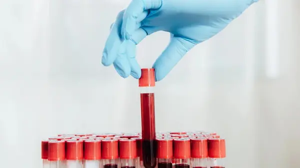 Наибольшие преимущества и риски заболеваний каждой группы крови