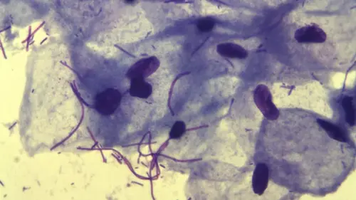 Бациллярная флора у женщин: норма и отклонения в результатах мазка