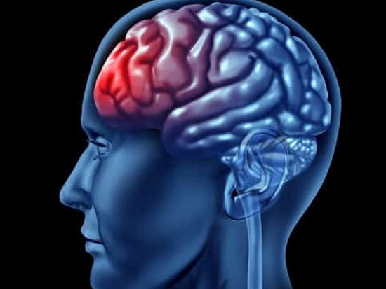 Признаки и последствия гематомы головного мозга