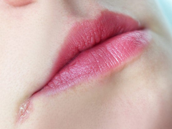 Неприятные заеды в уголках рта: причины и лечение
